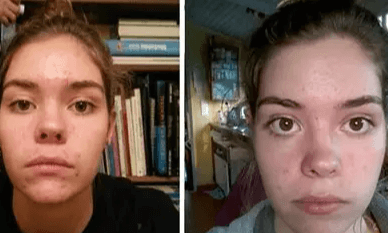 Kojic Acid Turmeric Cleansing Pads Beauty Hot-sale