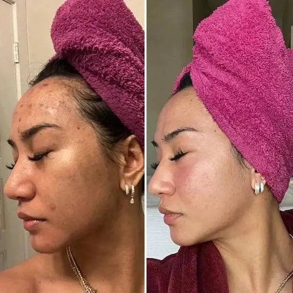 Kojic Acid Turmeric Cleansing Pads Beauty Hot-sale